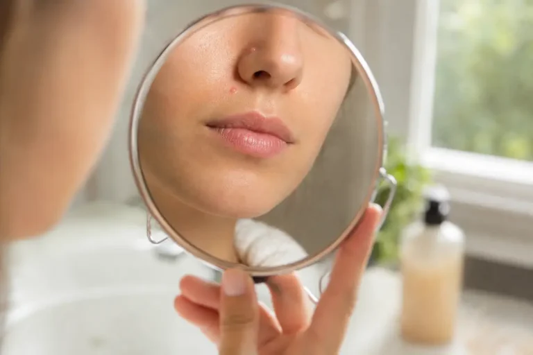 Illustration douce d’une personne observant un bouton près de la narine dans un miroir